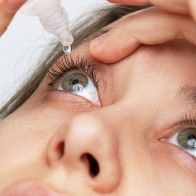 close-up of a woman putting eye drops into her eyes to treat dry eye syndrome