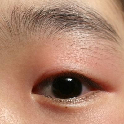 eye infection from mascara