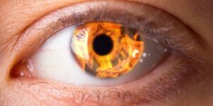 close-up of a person’s eye with flames representing burning eyes